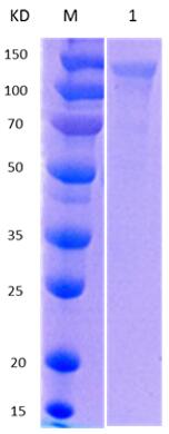 12% SDS-PAGE analysis profiles of purified MCR_RS03125-36-1074 (CBB stained).